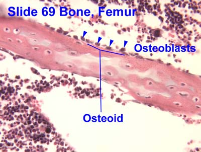 Osteoid Wikipedia